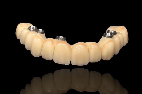 COURONNE ZIRCONE TRANSVISSEE