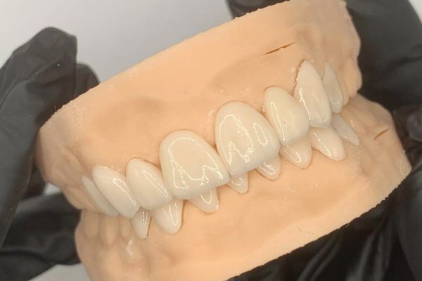 PRODUITS-DIGILAB3D-FACETTES PRODUITS-DIGILAB3D-FACETTES